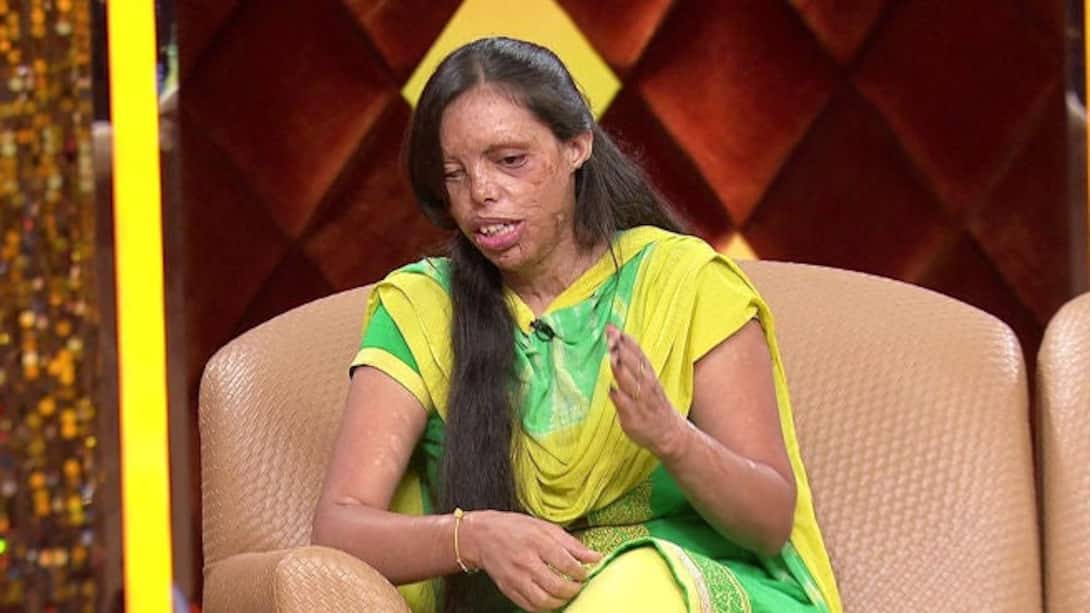 The ambition of Sonia, a victim of an acid attack